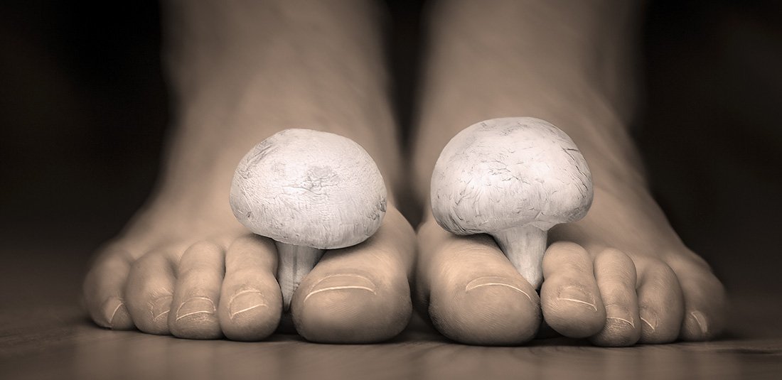 Struggling to Beat Your Fungal Nail Infection