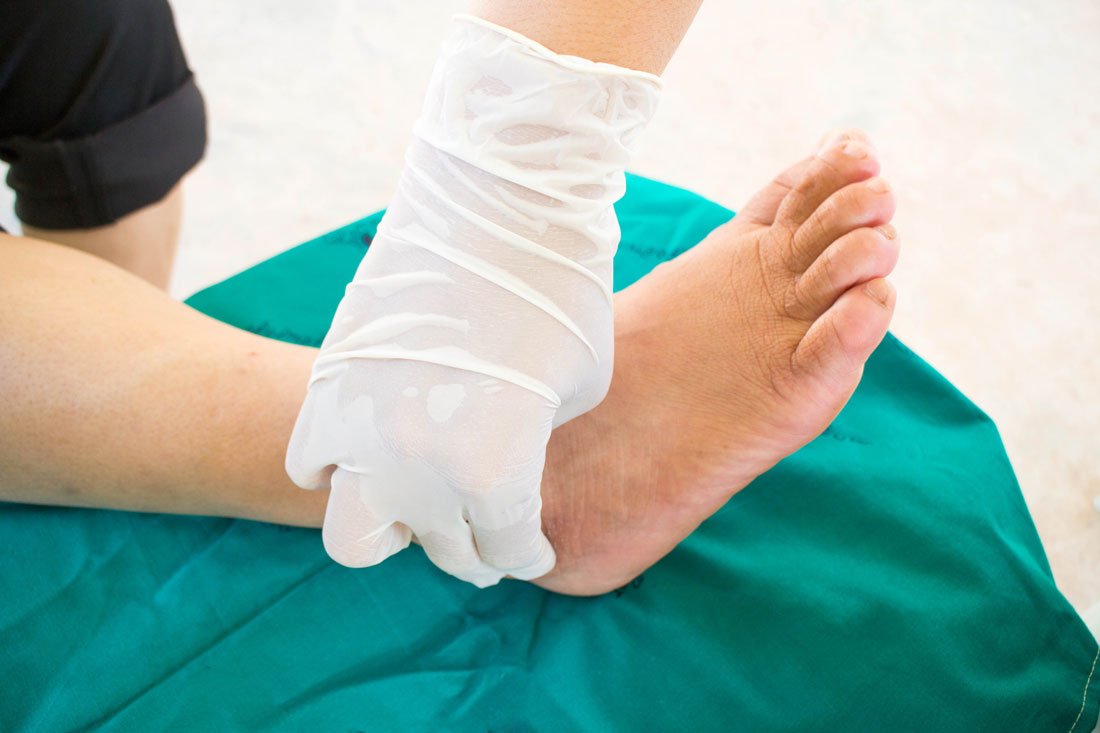 Swollen And Painful Foot