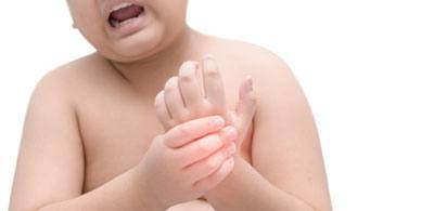 Arthritis In Kids