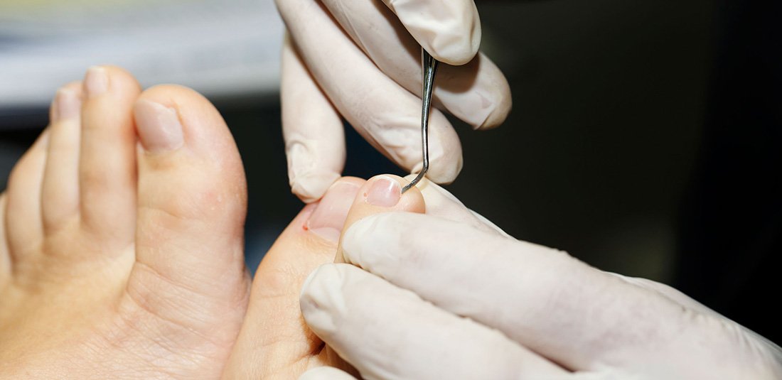 Why are My Toenails Getting Thicker?