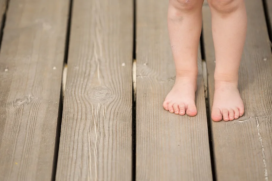 Paediatric Podiatry